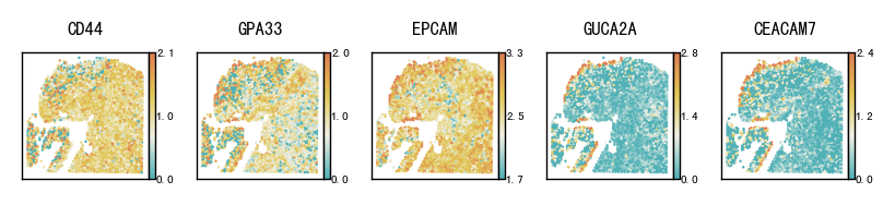 ../_images/notebooks_Pathological_region_detection_tutorial_18_1.png