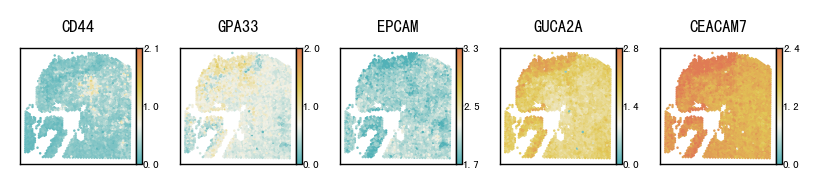 ../_images/notebooks_Pathological_region_detection_tutorial_18_3.png