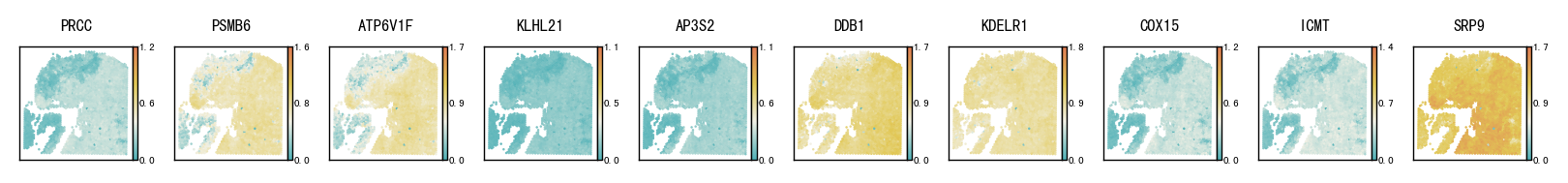 ../_images/notebooks_Pathological_region_detection_tutorial_20_3.png