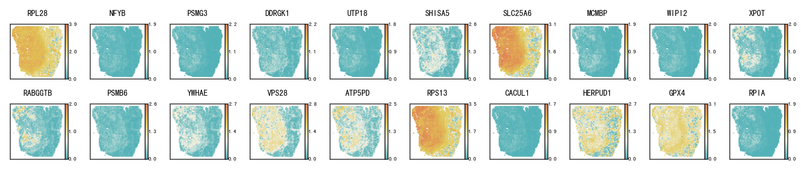 ../_images/notebooks_Pathological_region_detection_tutorial_24_3.png